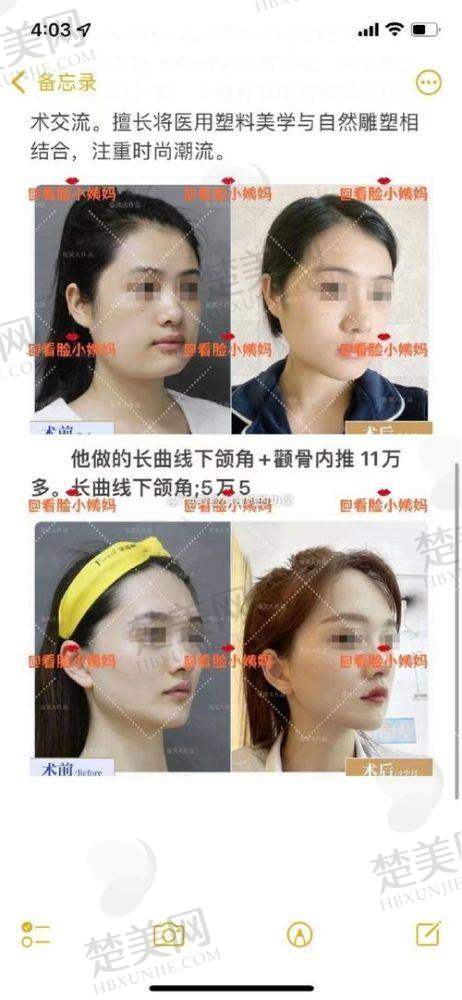 三、吴一医生技术怎么样？
