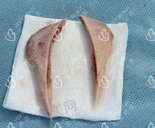 七、吴一医生真实的患者评价