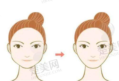 二、河南郑州华仁植发中 心：服务覆盖面超广