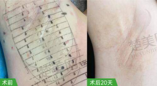 四、赣州华美医疗美容门诊部特色项目