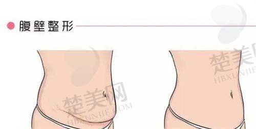 三、沈阳杏林隆胸手术价格及医生介绍