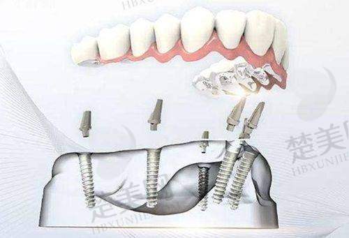 一、昭通昭阳西 南博大口腔门诊部正规吗？