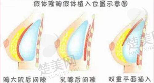 九、南昌颜咖医疗美容门诊部真实的患者评价