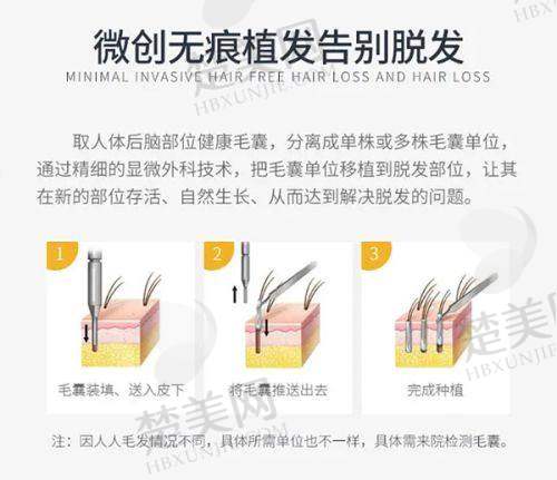 六、河南郑州华仁植发中 心：多重保护让你放心