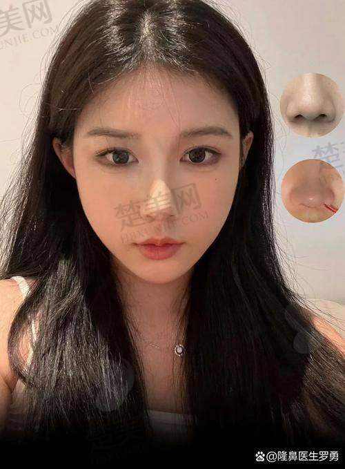 三、避坑指南：这些细节要牢记
