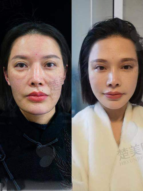 一、北京成好医疗美容——北京馒化脸修复好医院之一