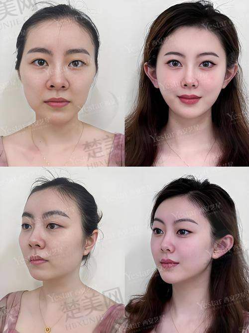五、北京麦西美嘉医疗美容——微整形修复馒化脸的特色医院