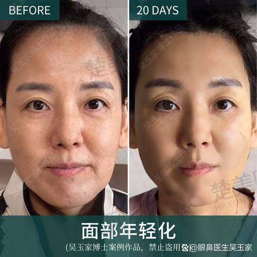 三、北京锦瑟医疗美容——激光修复馒化脸的佼佼者