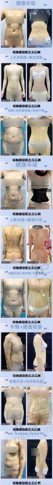 五、张春彦医生服务怎么样
