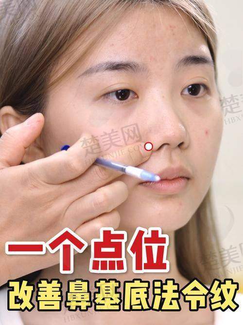 二、日常护理消除法令纹