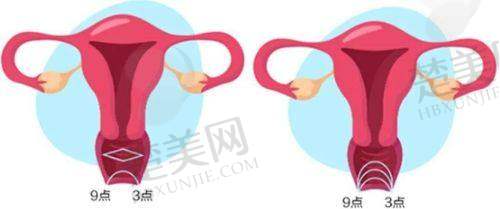 一、深圳打紧缩针：选对医院是关键