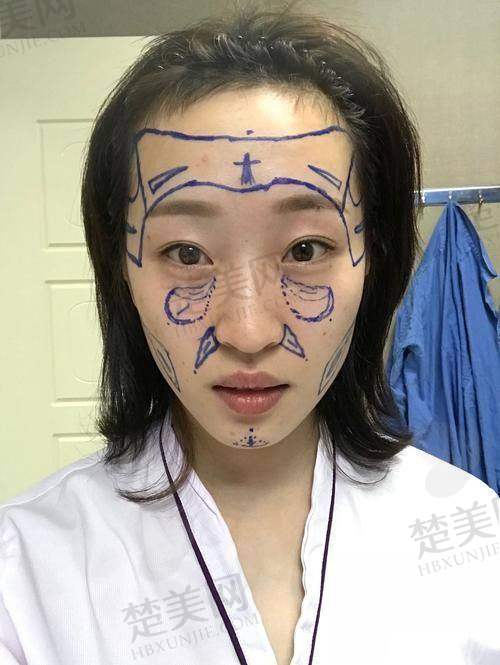 三、王自谦医生手术技术的具体优势