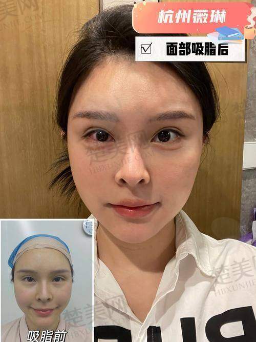 五、总结：重塑自然自信面容，王自谦医生值得信赖