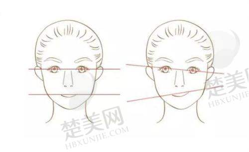 十、上海海华整形——综合特色整形医院