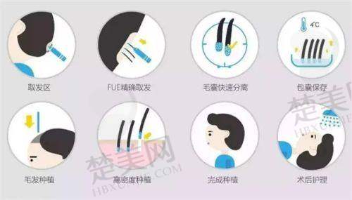 五、成都毛发种植哪家医院强之成都大麦微针植发门诊部