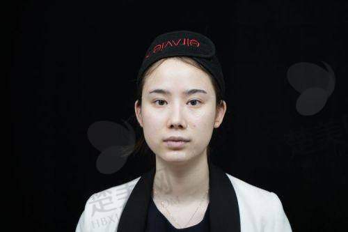 三、30岁开始有法令纹，医美项目有选择