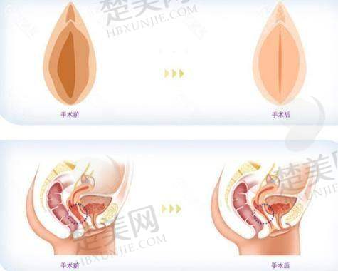 三、深圳私密整形的技术亮点