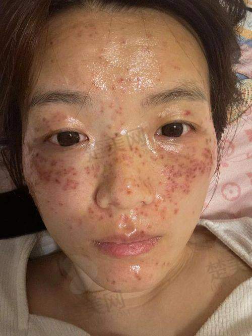 七、活动截止月底：抓住机会变白变得更美
