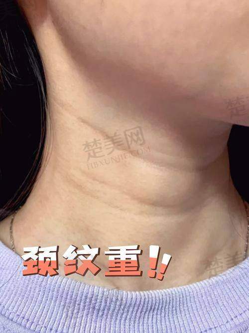 五、综合建议