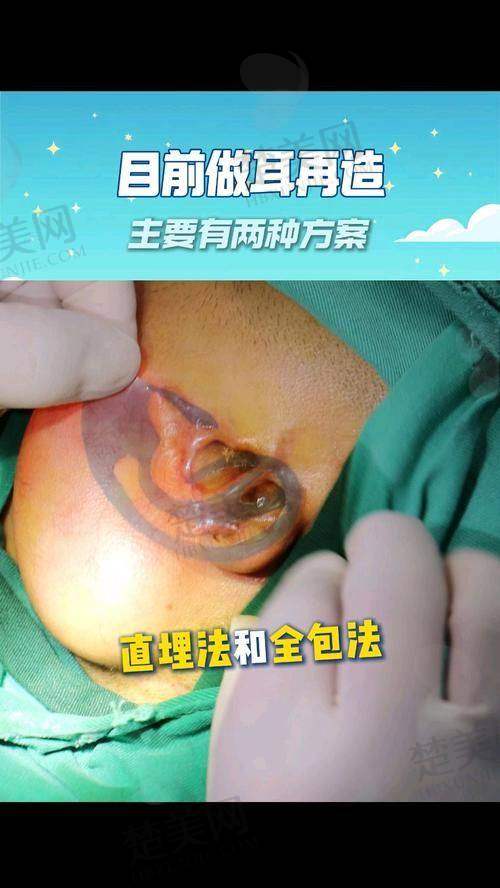 一、成都耳朵畸形再造医院排名前十名单分享