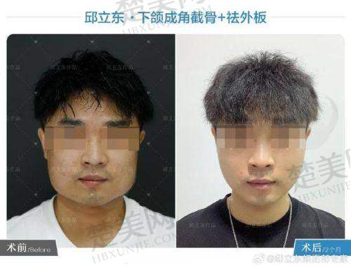 二、真实患者评价分享