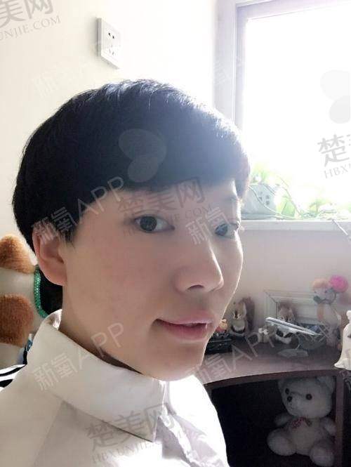 二、常见填充材料的特点对比
