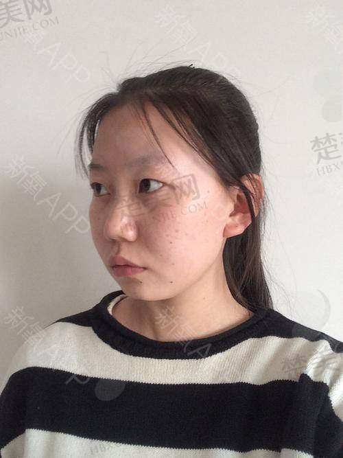 三、如何选择适合自己的填充材料