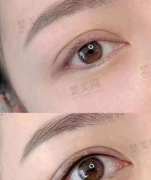 三、烟台雅思悦医疗美容门诊部诊疗项目有哪些？