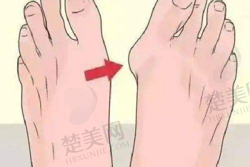 九、丽水小榕丽医疗美容诊所真实的患者评价