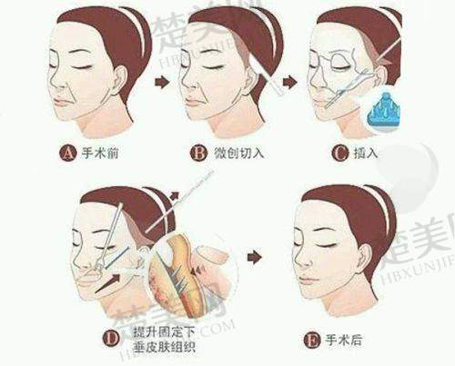 三、郑州梨花雨医疗美容门诊部诊疗项目有哪些？