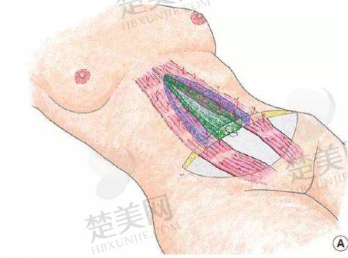 六、郑州梨花雨医疗美容门诊部价格表