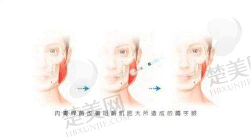 四、丽水小榕丽医疗美容诊所特色项目