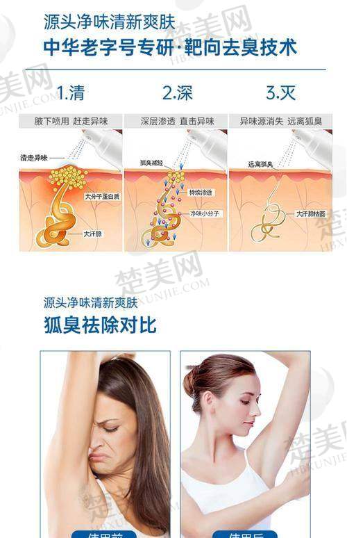 一、为什么选择清新微波治疗狐臭