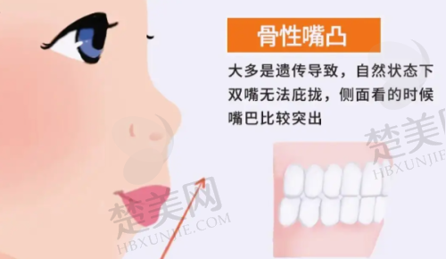 三、黄石中山口腔医院诊疗项目有哪些？