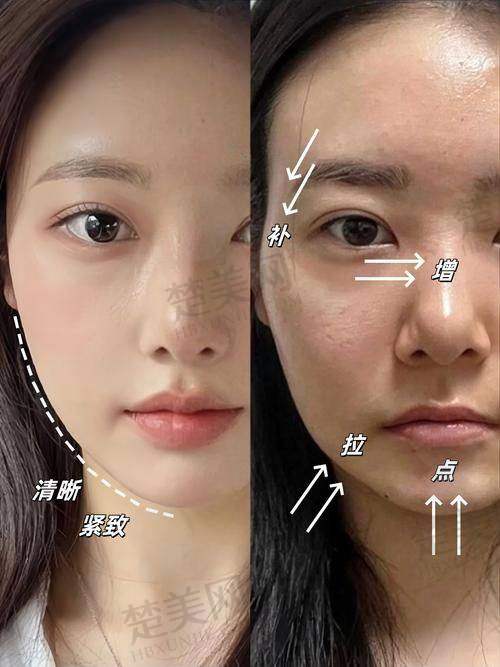 一、了解法令纹和皱纹的成因