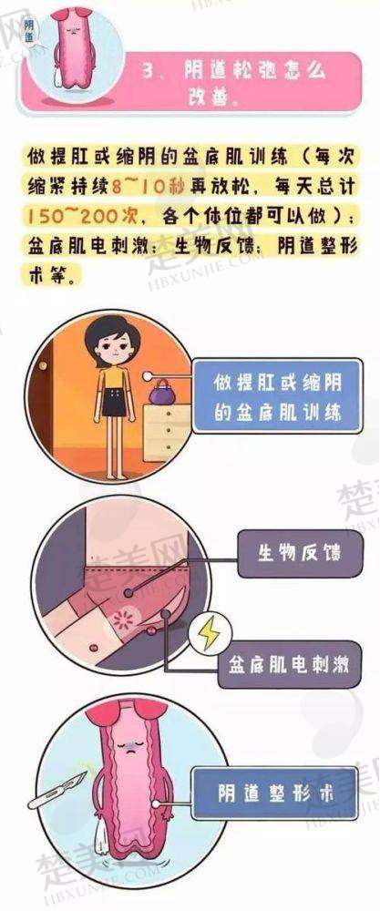 四、影响阴道紧缩针结果持续时间的因素