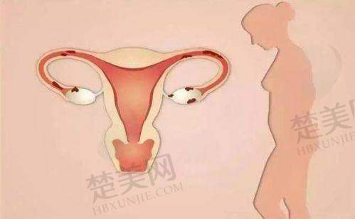 六、延长阴道紧缩针结果的方法