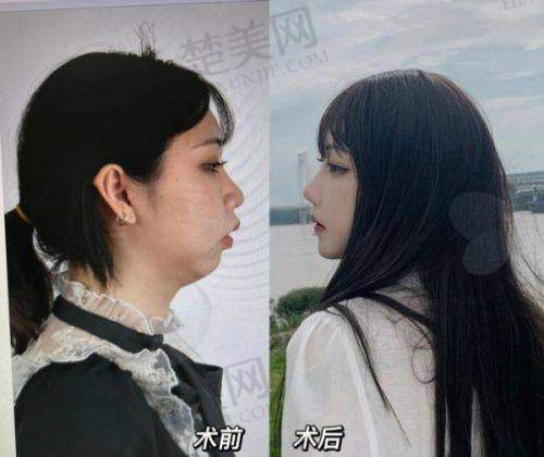 三、潍坊壹美整形——纯韩技术打造时尚之美