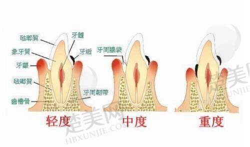四、佛山第一人民医院美容科胸部整形项目价格