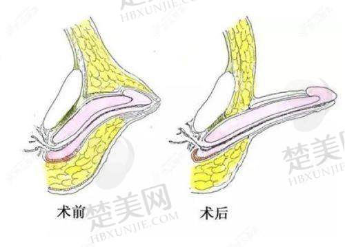 七、总结