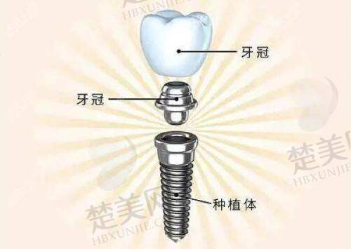 三、镇江雅澳口腔门诊部诊疗项目有哪些？