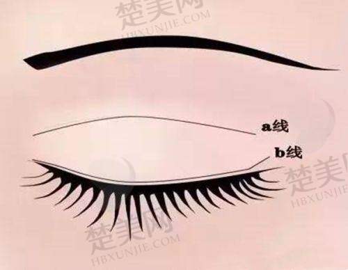 二、长沙天心希美医疗美容门诊部怎么样？