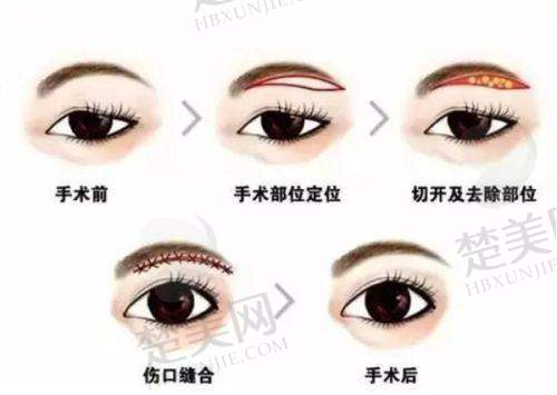 三、永州博美医疗美容医院诊疗项目有哪些？