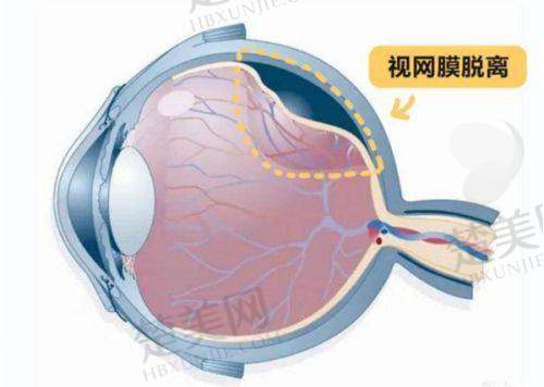 一、南宁普瑞眼科医院——南宁飞秒激光手术医院排名第一