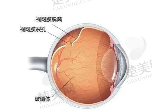 二、绍兴爱尔眼科医院——绍兴晶体植入医院排名前列的连锁品牌
