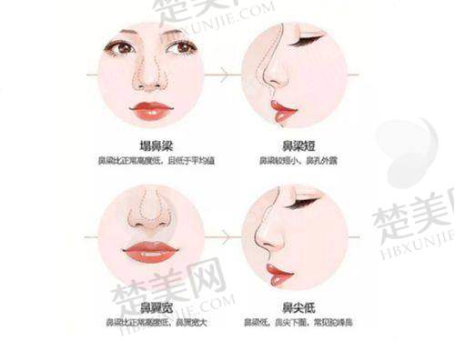 七、北京画美医院的私立医院特色