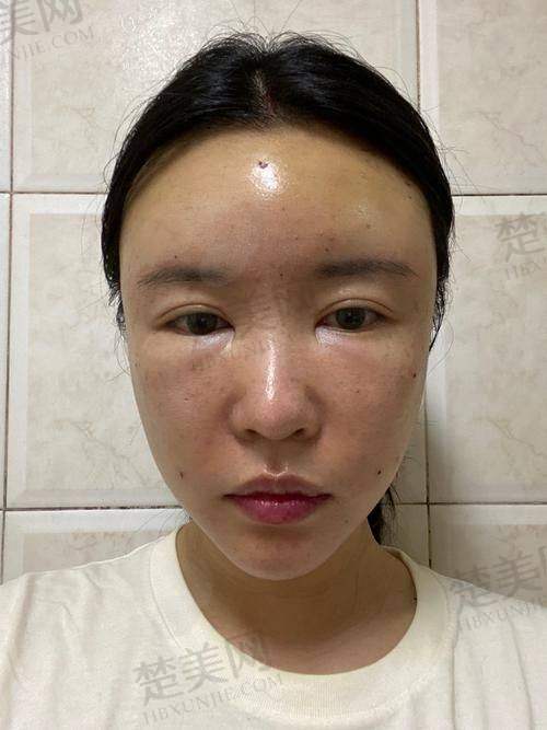 三、北京其他脂肪填充好的医院排名及亮点