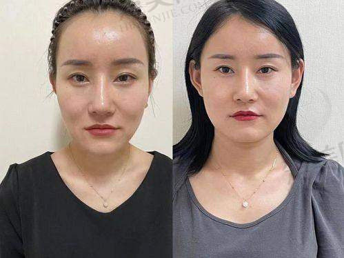 七、与上海玻尿酸填充相关的医生介绍