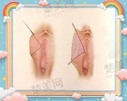 五、上海薇琳医疗美容