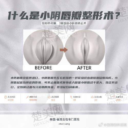 三、郑州科 大私密整形张红歌医生专做私密整形15年的优势